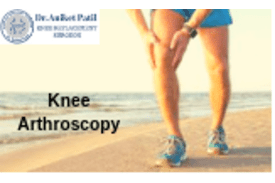 Knee Arthroscopy Surgeon Pune and Pimpri Chinchwad (PCMC)