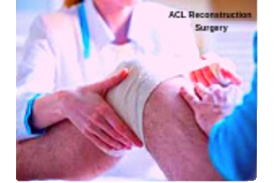 Acl reconstruction surgery in pune and pcmc