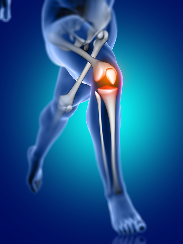 Knee Arthroscopy Surgery