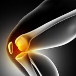 Total Knee joint Replacement in Pune