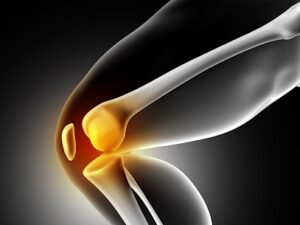 Total Knee joint Replacement in Pune