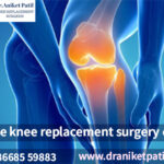 knee replacement surgery coast in pune