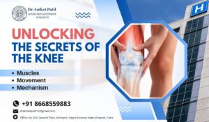 Dr Aniket Patil locking and unlocking of knee joint in kharadi Pune