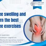 Dr Aniket Patil kharadi Pune - Understanding Knee Swelling Causes Symptoms and Best Knee Exercises