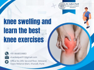 Dr Aniket Patil kharadi Pune - Understanding Knee Swelling Causes Symptoms and Best Knee Exercises
