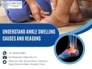 Dr Anikte Patil Kharadi Pune-Understanding Ankle Swelling Causes Reasons and When to Seek Help